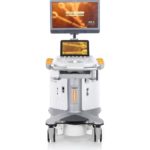 Аппарат УЗИ Siemens ACUSON S3000 — изображение 2