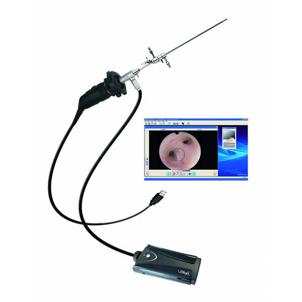 Диагностическая эндовидеокамера Sopro 181_69db6825f25c6.jpeg Диагностическая эндовидеокамера Sopro 181 — изображение 3