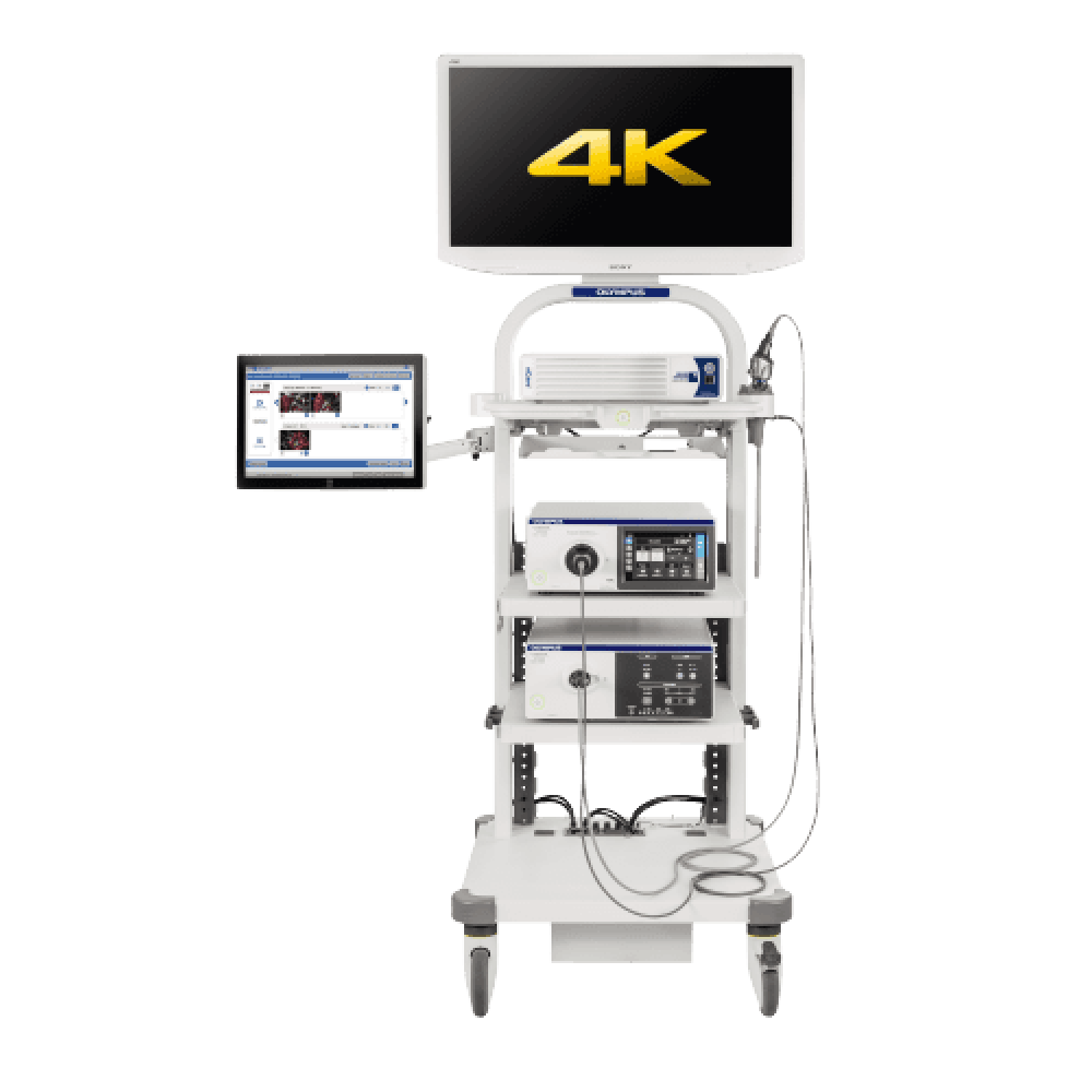 Эндоскопическая система OLYMPUS VISERA 4K UHD_69db6380c0793.png Эндоскопическая система OLYMPUS VISERA 4K UHD — изображение 1