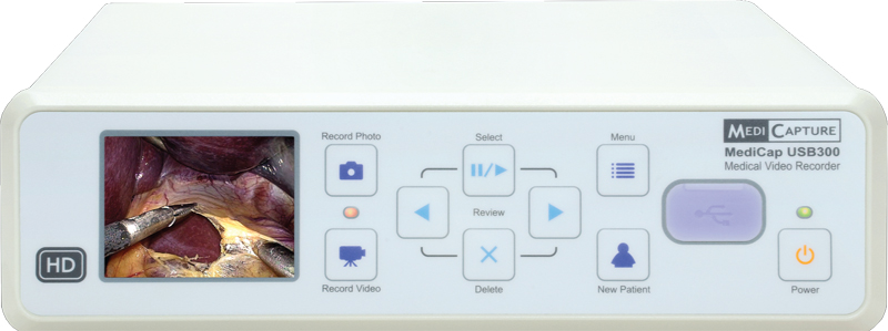 Медицинский цифровой HD-рекордер MediCap USB300_69db6512c88cc.jpeg Медицинский цифровой HD-рекордер MediCap USB300 — изображение 2