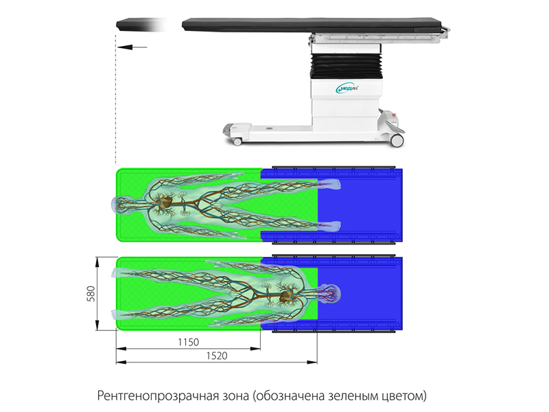 Операционный стол МЕДИН-САФИС_69dbe2b1963af.jpeg Операционный стол МЕДИН-САФИС — изображение 3