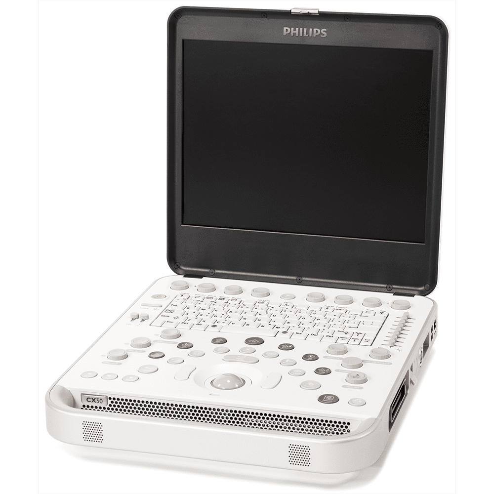 Ультразвуковая диагностическая система Philips CX50_69dabe4bac197.jpeg Ультразвуковая диагностическая система Philips CX50 — изображение 4