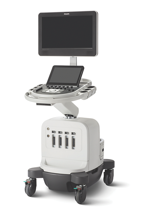 УЗИ-аппарат Philips Affiniti 30_69dabe3dbb3ab.png УЗИ-аппарат Philips Affiniti 30 — изображение 1