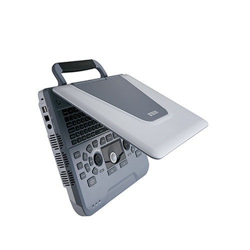 УЗИ аппарат Siui Apogee 1100 Neo_69d3af39000b0.jpeg УЗИ аппарат Siui Apogee 1100 Neo — изображение 3