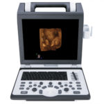 УЗИ аппарат SIUI CTS 7700 — изображение 2