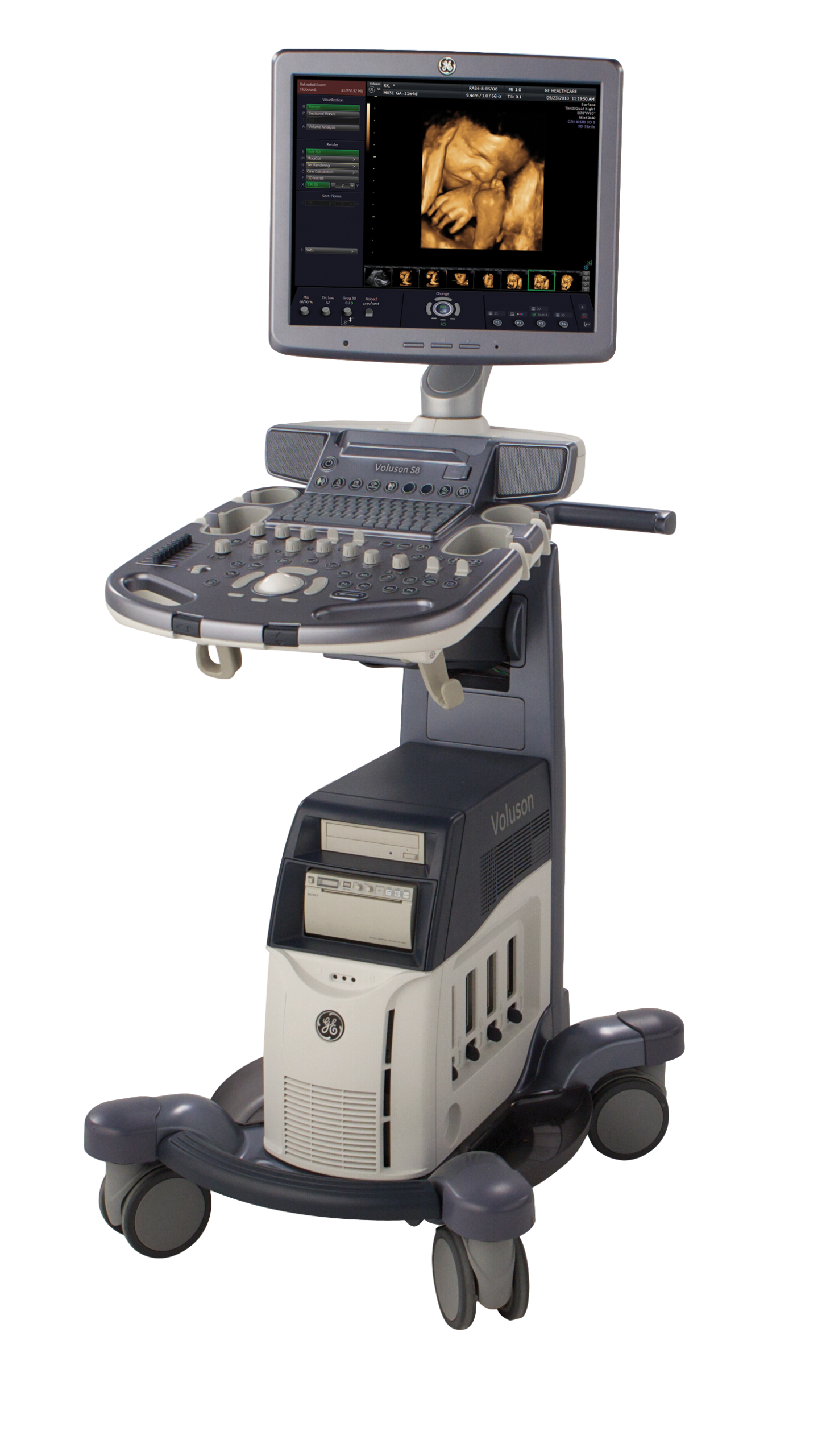 УЗИ оборудование GE Voluson S6_69dabdd32ff96.png УЗИ оборудование GE Voluson S6 — изображение 1