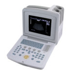 УЗИ сканер Med-Mos CMS600B3 — изображение 3