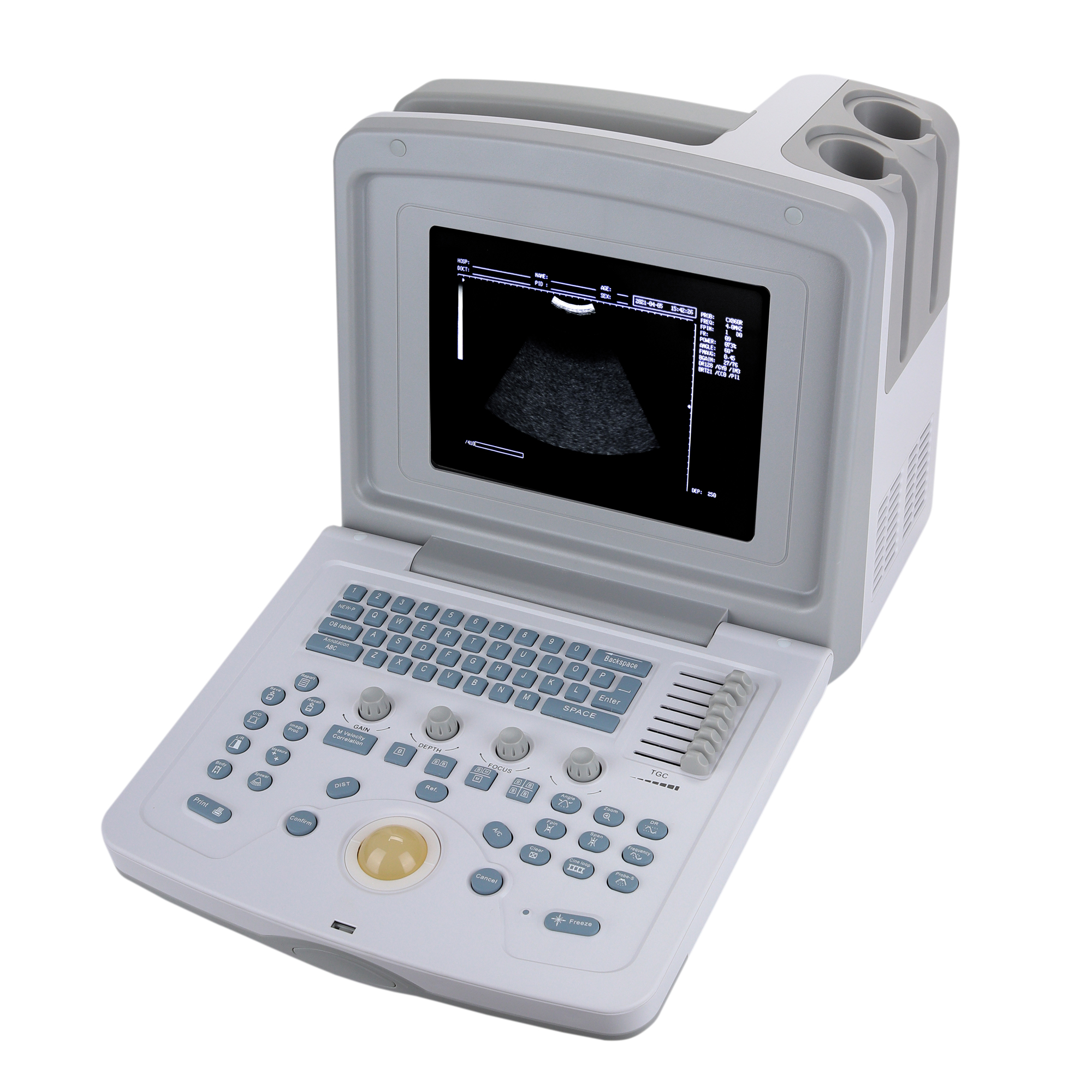 УЗИ сканер Med-Mos CMS600B3_69d3ae1ac0c51.jpeg УЗИ сканер Med-Mos CMS600B3 — изображение 3